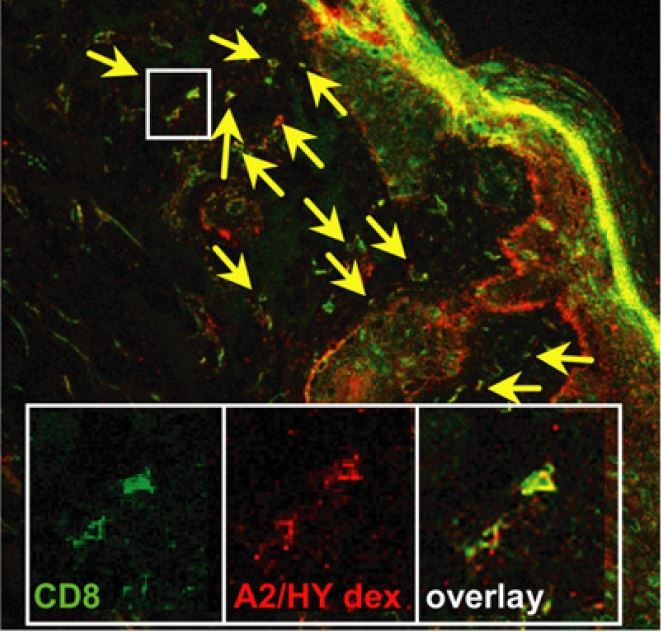 in-situ-staining-with-dextramer